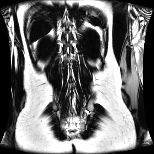 Normal MRI abdomen in pregnancy (Radiopaedia 88001-104541 N 115).jpg