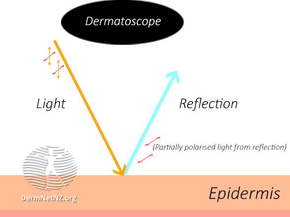 File:Normal light reflection off skin (DermNet NZ normal-light).jpg