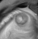 Normal brain fetal MRI - 22 weeks (Radiopaedia 50623-56050 Coronal T2 Haste 1).jpg
