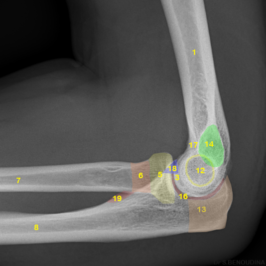 File:Normal radiographic anatomy of the elbow (Radiopaedia 48021-52819 Lateral 1).jpg