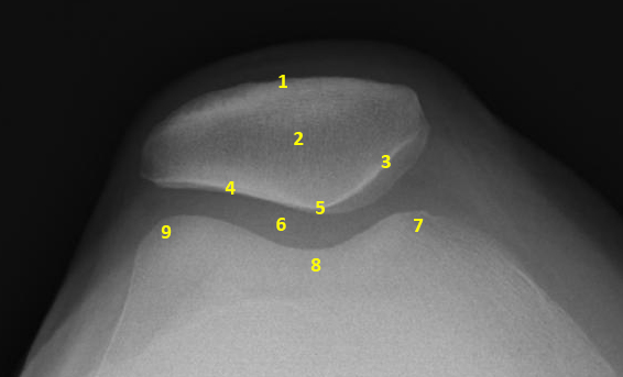 File:Annotated normal tangential projection (knee) (Radiopaedia 46021).jpg