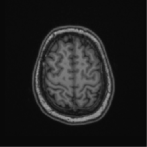 File:Cerebellar hemangioblastomas and pituitary adenoma (Radiopaedia 85490-101176 Axial T1 61).png
