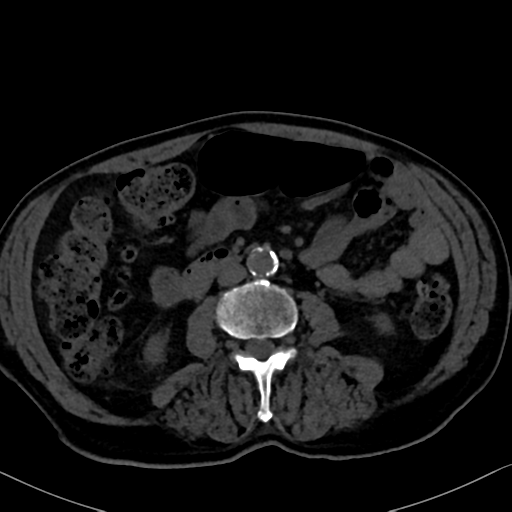 File:Normal CT intravenous cholangiogram (Radiopaedia 38199-40208 Axial IVC 63).png