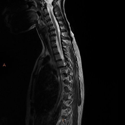 File:Normal spine MRI (Radiopaedia 77323-89408 E 9).jpg