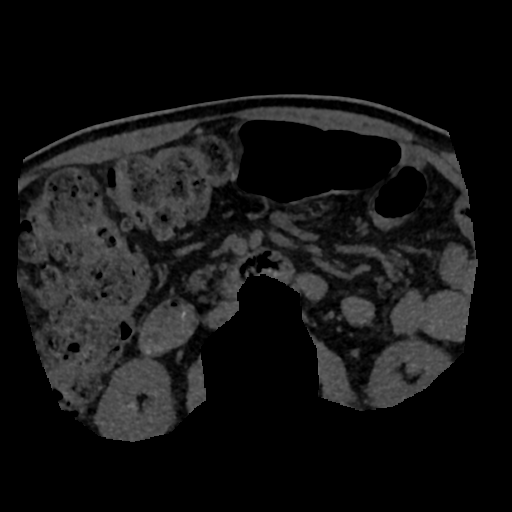 File:Normal CT intravenous cholangiogram (Radiopaedia 38199-40208 Axial IVC (MIP) 2).png