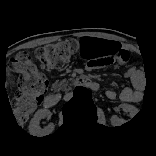 File:Normal CT intravenous cholangiogram (Radiopaedia 38199-40208 Axial IVC (MIP) 8).png