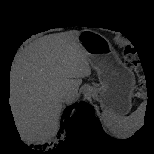 File:Normal CT intravenous cholangiogram (Radiopaedia 38199-40208 Axial IVC (MIP) 73).png
