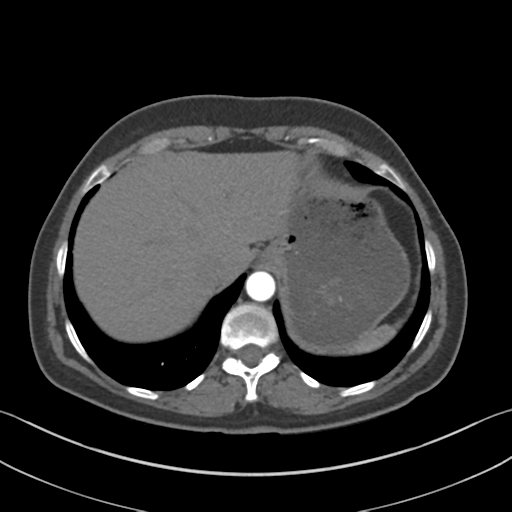 File:Normal CT renal artery angiogram (Radiopaedia 38727-40889 A 14).png