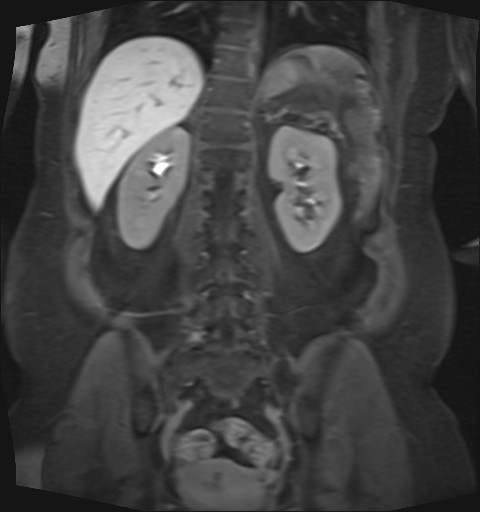 File:Normal hepatobiliary phase liver MRI (Radiopaedia 58968-66230 B 15).jpg