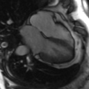 File:Cardiac MRI- standard imaging planes (Radiopaedia 14225-14090 B 15).jpg