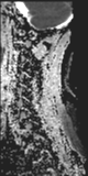 File:Normal MRI cervical spine (infection protocol) (Radiopaedia 53916-60039 Sagittal 12).png