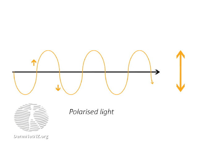 File:Polarised light (DermNet NZ polarised-light).jpg