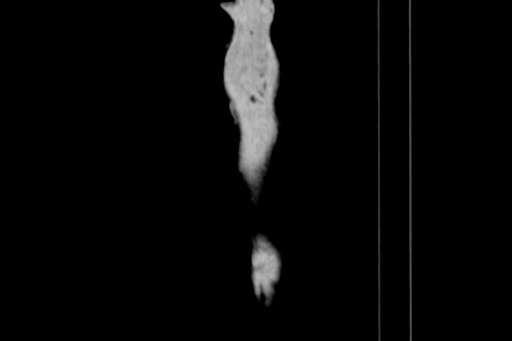 Anterior inferior iliac spine avulsion injury (Radiopaedia 88666-105376 Sagittal bone window 1).jpg
