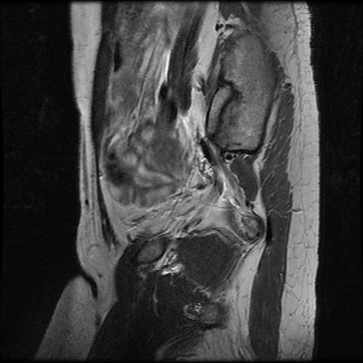 File:Normal female pelvis MRI (retroverted uterus) (Radiopaedia 61832-69933 Sagittal T2 7).jpg