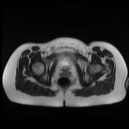 Normal MRI abdomen in pregnancy (Radiopaedia 88003-104546 Axial T2 48).jpg