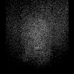 Astrocytoma (Radiopaedia 85660-101440 I 176).jpg