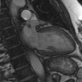 File:Cardiac MRI- standard imaging planes (Radiopaedia 14225-14090 A 6).jpg