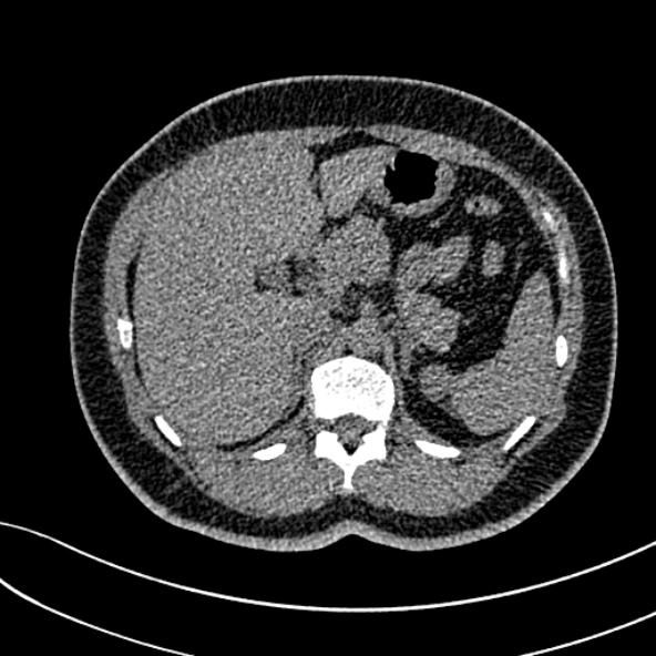 Normal CT chest- adult female (Radiopaedia 52522-58428 Axial non-contrast 135).jpg