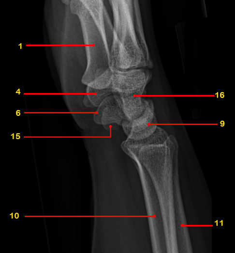 File:Normal radiographic anatomy of the wrist (Radiopaedia 43305-46649 Lateral 1).jpg