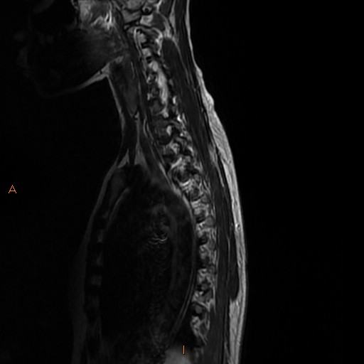 File:Normal spine MRI (Radiopaedia 77323-89408 E 11).jpg