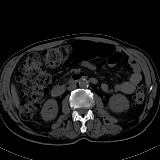 File:Normal CT intravenous cholangiogram (Radiopaedia 38199-40208 Axial IVC 56).png