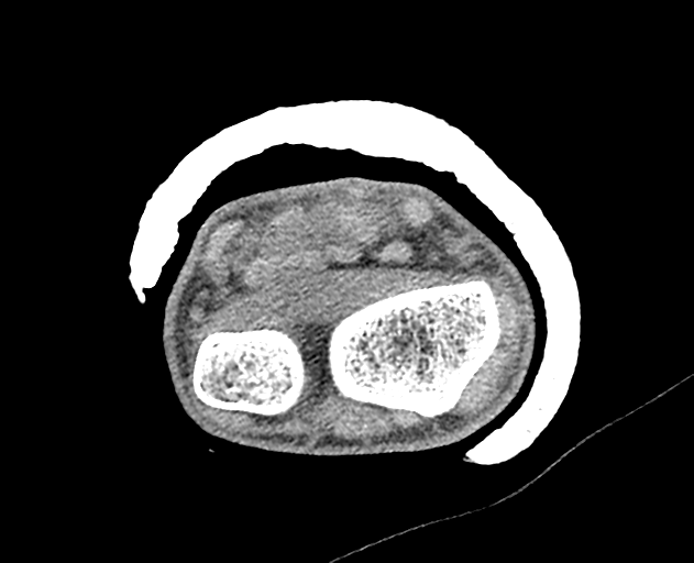 Normal wrist CT (Radiopaedia 41425-44297 Axial non-contrast 41).png