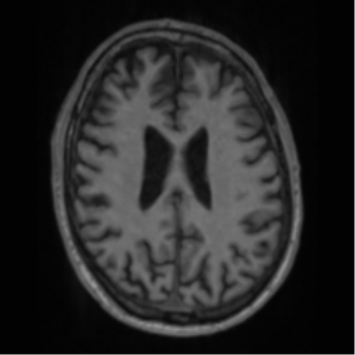 File:Alzheimer's disease- with apraxia (Radiopaedia 54763-61011 Axial T1 48).png