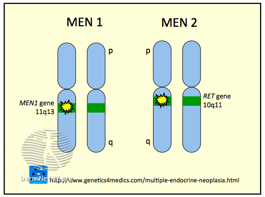 File:Multiple Endocrine Neoplasia MEN (DermNet NZ Multiple-Endocrine-Neoplasia-MEN).png