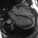 File:Cardiac MRI- standard imaging planes (Radiopaedia 14225-14090 B 28).jpg