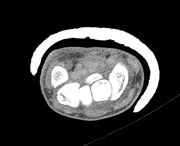Normal wrist CT (Radiopaedia 41425-44297 Axial non-contrast 30).png