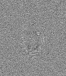 Central neurocytoma (Radiopaedia 84497-99872 Axial 71).jpg