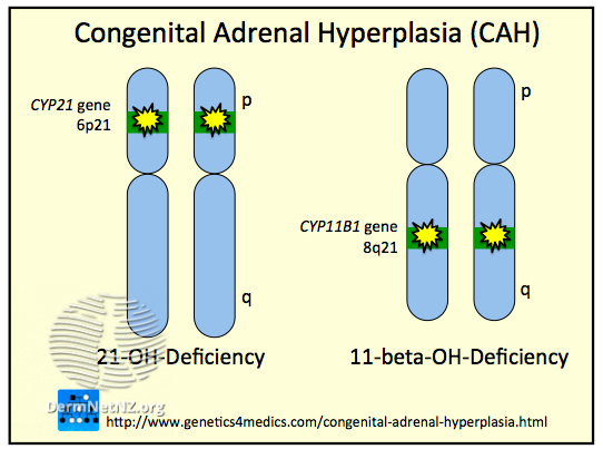 File:Congenital Adrenal Hyperplasia CAH (DermNet NZ Congenital-Adrenal-Hyperplasia-CAH).png