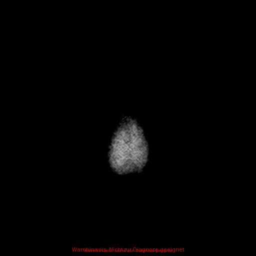 Normal adult brain MRI (non-enhanced and contrast-enhanced) (Radiopaedia 75262-86379 Axial T1 C+ 184).jpg