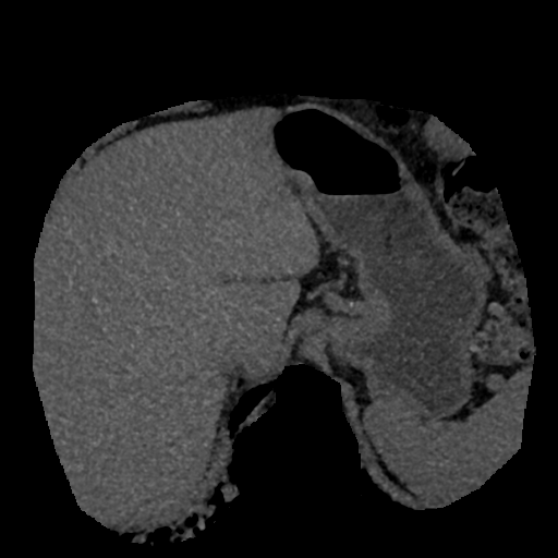 File:Normal CT intravenous cholangiogram (Radiopaedia 38199-40208 Axial IVC (MIP) 70).png
