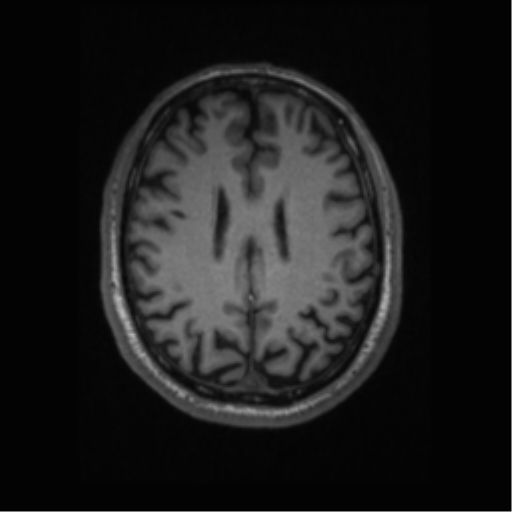 File:Alzheimer disease - probable (Radiopaedia 35334-36837 Axial T1 50).png