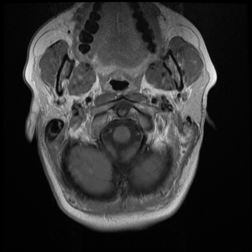 File:Normal cervical and thoracic spine MRI (Radiopaedia 35630-37156 Axial T1 C+ 32).png