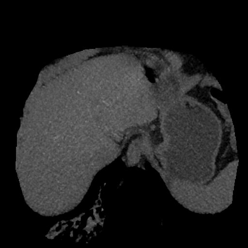 File:Normal CT intravenous cholangiogram (Radiopaedia 38199-40208 Axial IVC (MIP) 80).png