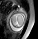 File:Normal brain fetal MRI - 22 weeks (Radiopaedia 50623-56050 Axial T2 Haste 1).jpg