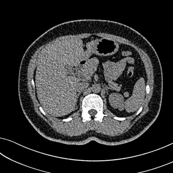Normal CT chest- adult female (Radiopaedia 52522-58428 Axial non-contrast 138).jpg