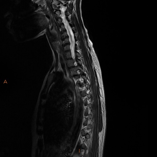 File:Normal spine MRI (Radiopaedia 77323-89408 E 10).jpg