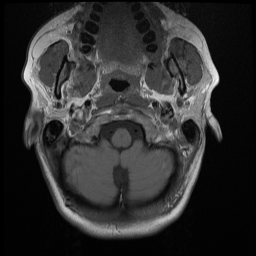 File:Normal cervical and thoracic spine MRI (Radiopaedia 35630-37156 Axial T1 33).png