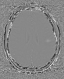 Cerebral cavernous venous malformation (Radiopaedia 70008-80021 G 48).jpg