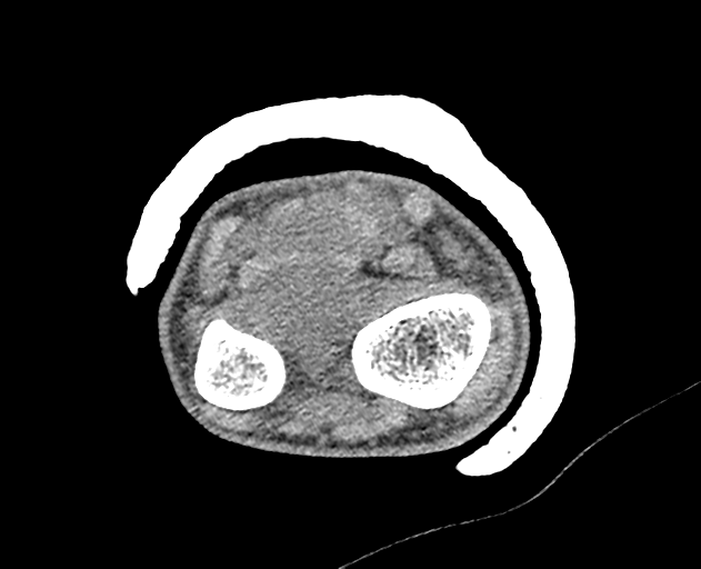 Normal wrist CT (Radiopaedia 41425-44297 Axial non-contrast 44).png