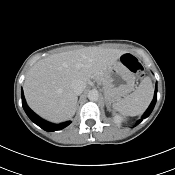 File:Normal multiphase CT liver (Radiopaedia 38026-39996 Axial C+ delayed 16).jpg