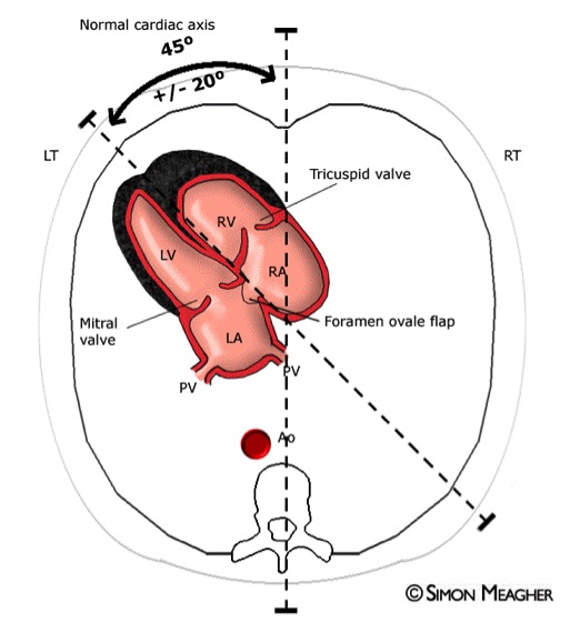 File:Normal fetal echocardiogram (Radiopaedia 26830-26993 A 1).jpg