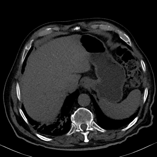 File:Normal CT intravenous cholangiogram (Radiopaedia 38199-40208 Axial IVC 18).png
