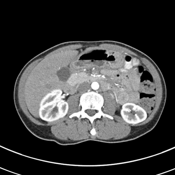 File:Normal multiphase CT liver (Radiopaedia 38026-39996 B 39).jpg