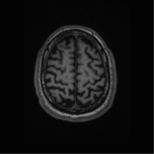 File:Alzheimer disease - probable (Radiopaedia 35334-36837 Axial T1 61).png