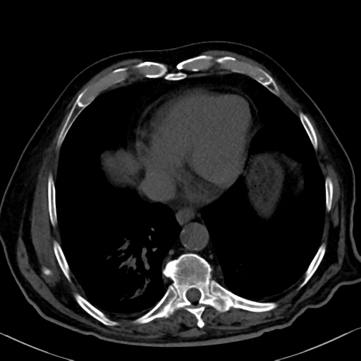 File:Normal CT intravenous cholangiogram (Radiopaedia 38199-40208 Axial IVC 9).png