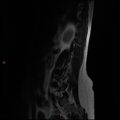 File:Normal spine MRI (Radiopaedia 77323-89408 Sagittal T2 12).jpg